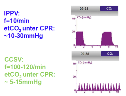 CCSV IPPV graphs 