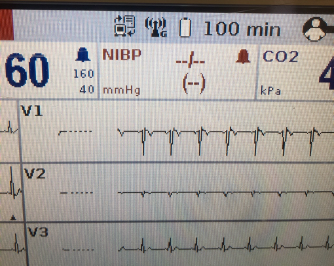 d-ecg2