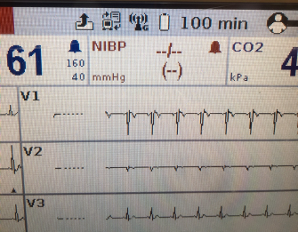 d-ecg3