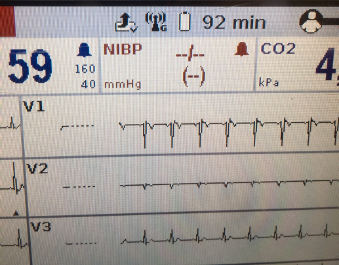 d-ecg4