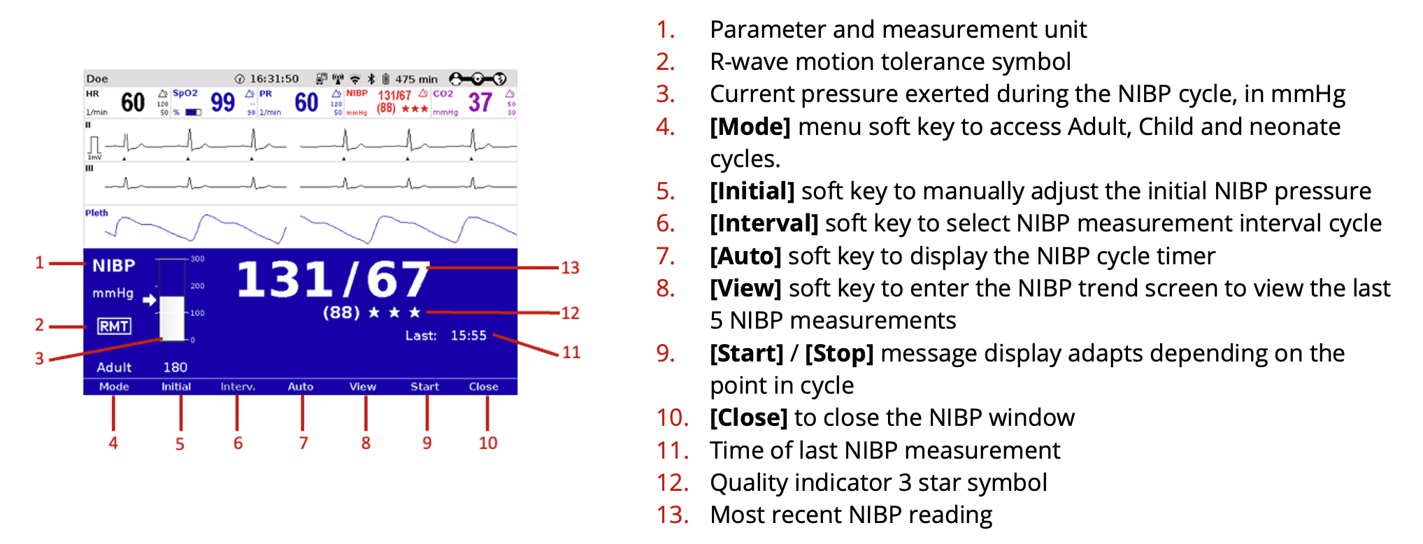 NIBP Monitoring